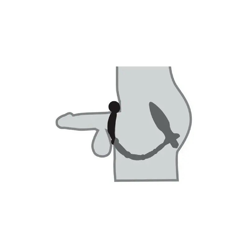 Dilatador con anillo vibrador